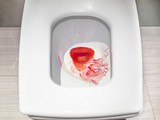 The 5 Best Toilet Seat For Hemorrhoids