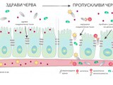 Тест – имаш ли пропускливи черва
