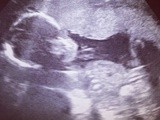 Baby Nelly - Second Trimester Update