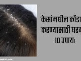 10 Easy Home Remedies: How To Get Rid Of Dandruff In Marathi