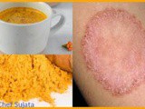 Home Remedies with Haldi for Ringworm and other Diseases in Marathi